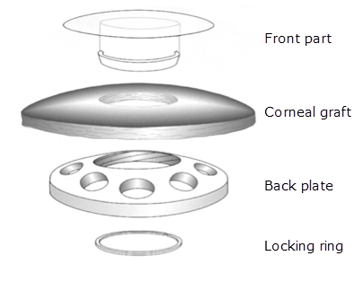 Keratoprosthesis Diagram